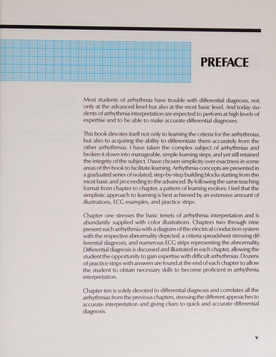 Differential diagnosis of arrhythmias