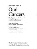 A colour atlas of oral cancers