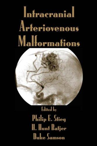 Intracranial arteriovenous malformations
