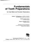 Fundamentals of tooth preparations