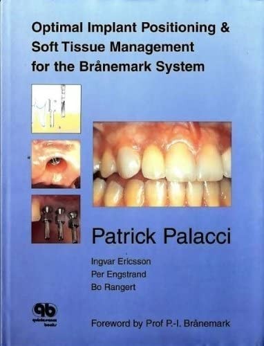 Optimal implant positioning and soft tissue management for the Branemark system