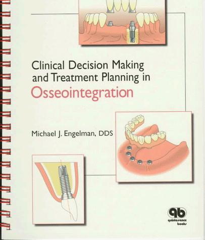Clinical decision making and treatment planning in osseointegration