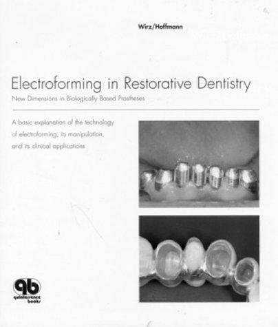 Electroforming in restorative dentistry