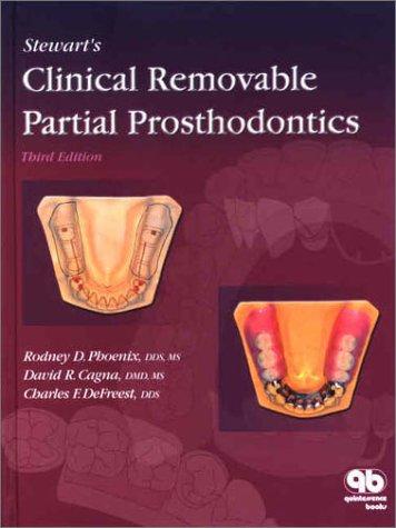 Stewart`s clinical removable partial prosthodontics