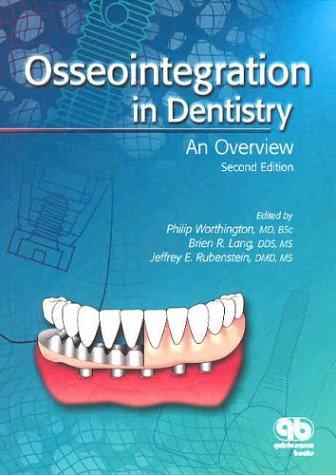 Osseointegration in dentistry