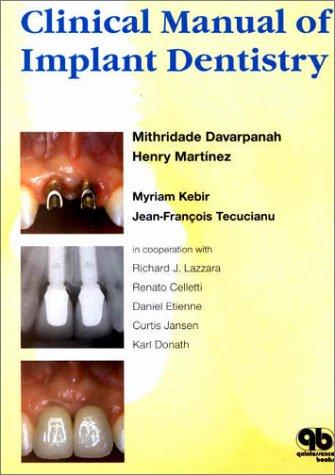 Clinical manual of implant dentistry