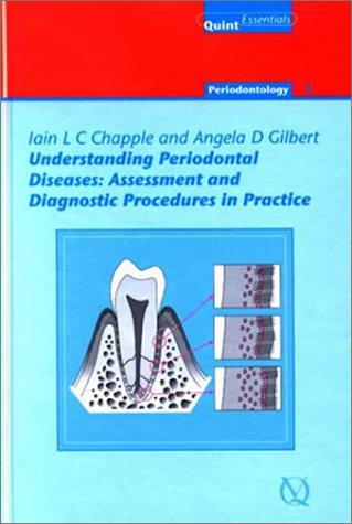 Understanding periodontal diseases