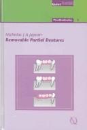 Removable partial dentures