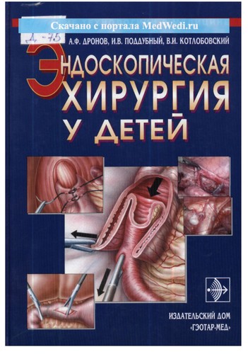 Эндоскопическая хирургия у детей