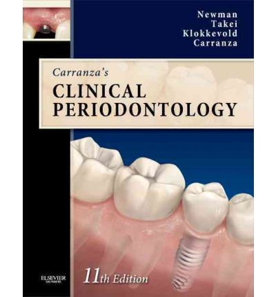 Carranza`s clinical periodontology