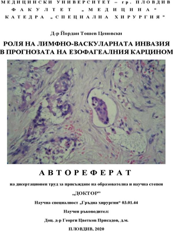 Роля на лимфно-васкуларната инвазия в прогнозата на езофагеалния карцином