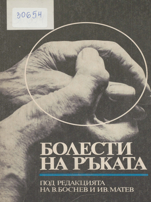 Болести на ръката