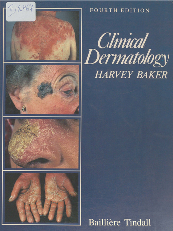 Clinical Dermatology
