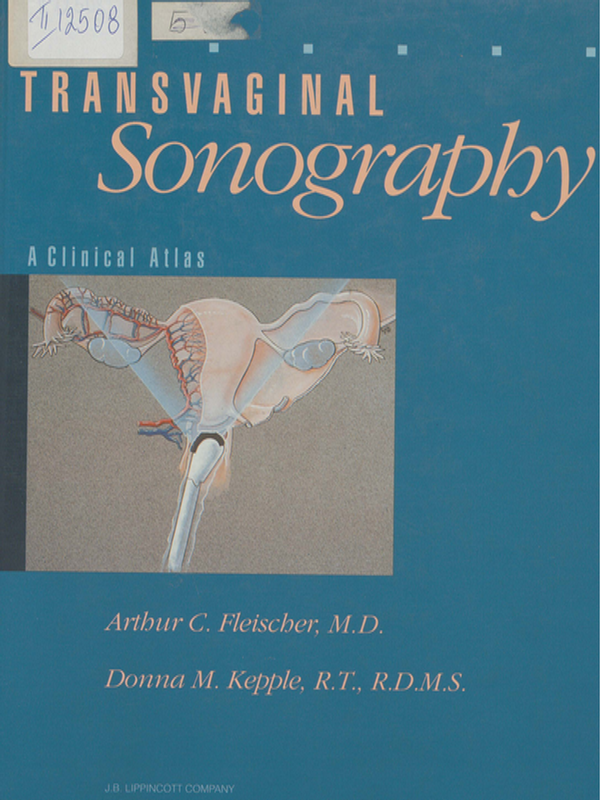 Transvaginal sonography