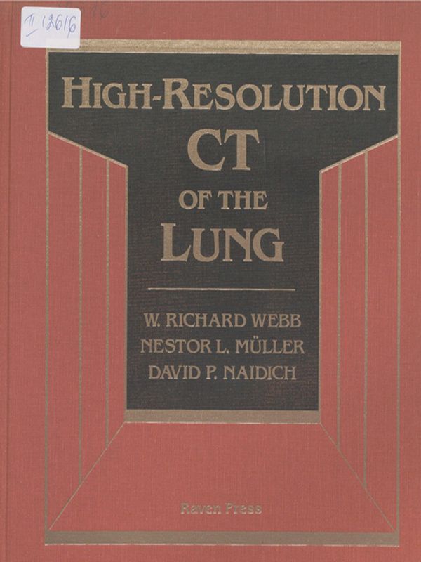 High-resolution CT of the lung