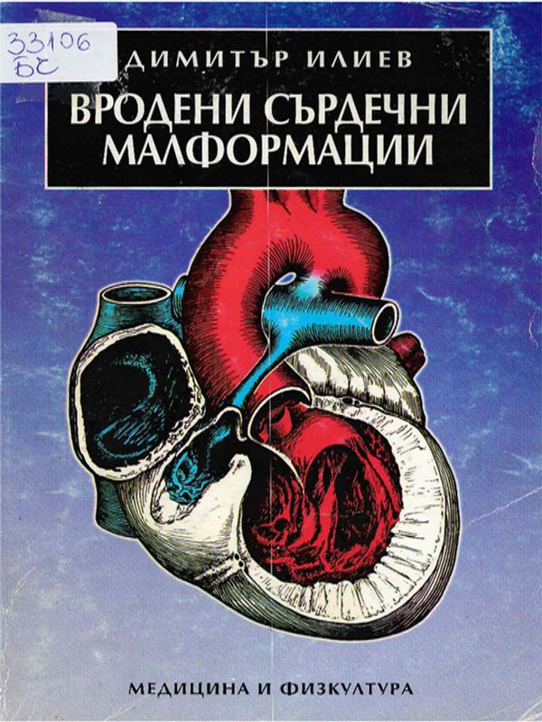 Вродени сърдечни малформации