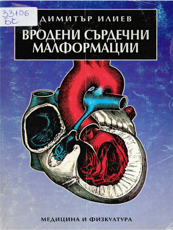 Вродени сърдечни малформации