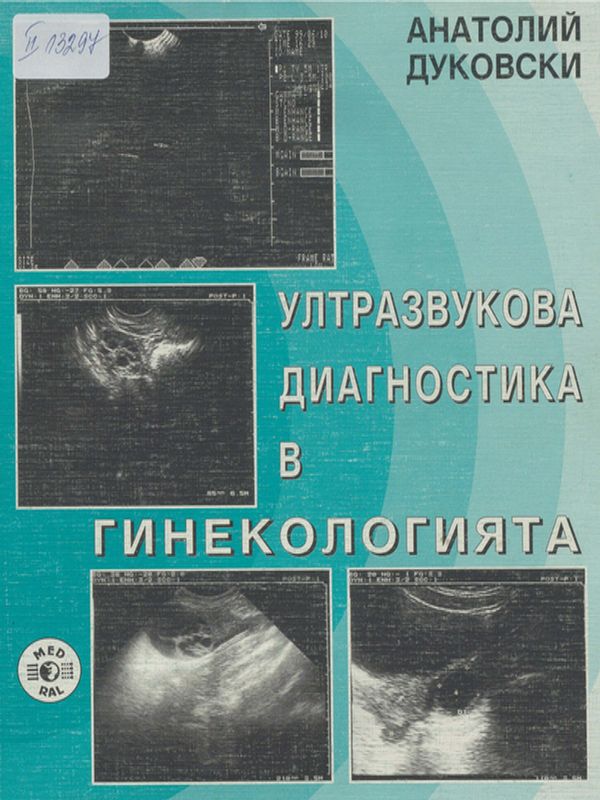 Ултразвукова диагностика в гинекологията