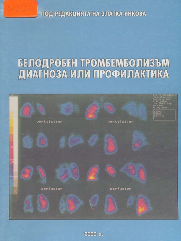 Белодробен тромбемболизъм диагноза или профилактика
