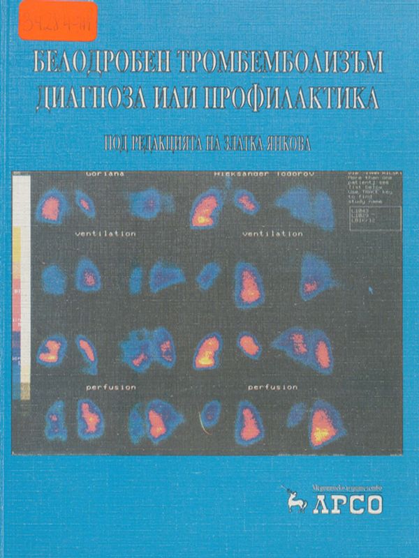 Белодробен тромбемболизъм