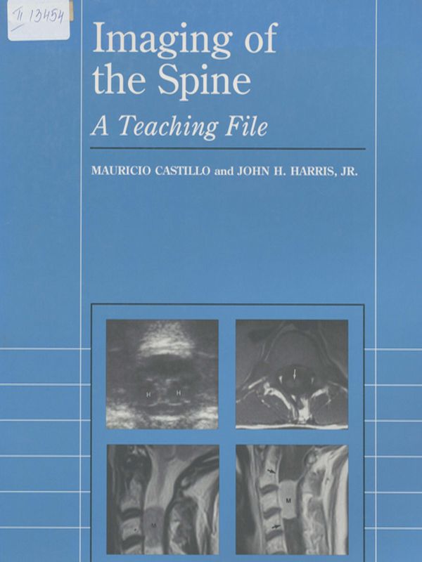 Imaging of the spine