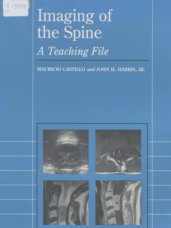 Imaging of the spine