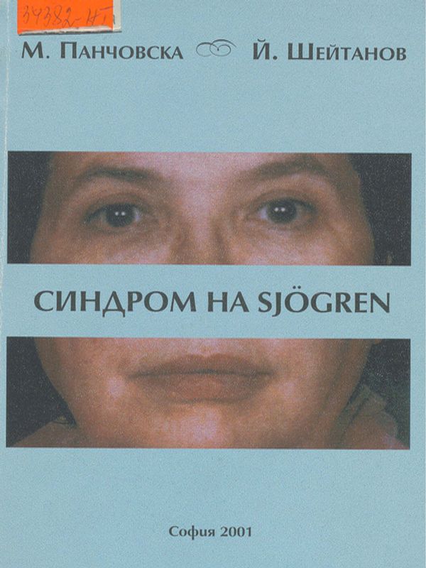 Синдром на Sjogren
