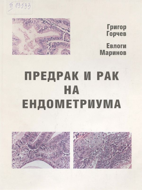 Предрак и рак на ендометриума