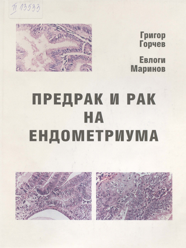 Предрак и рак на ендометриума