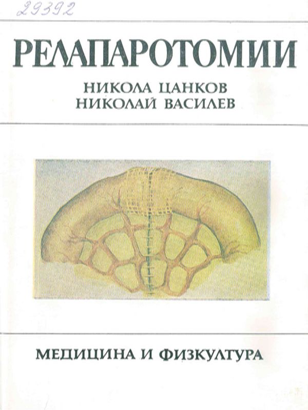 Релапаротомии