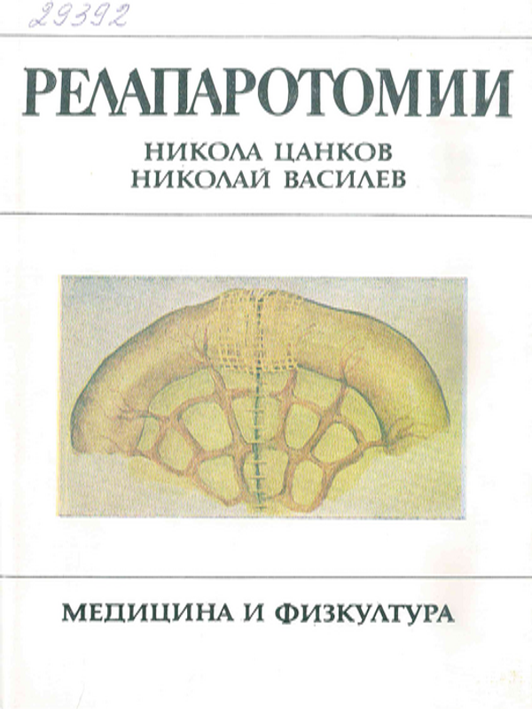 Релапаротомии