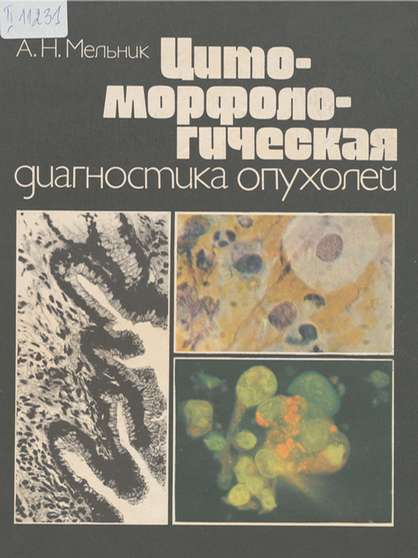 Цитоморфологическая диагностика опухолей