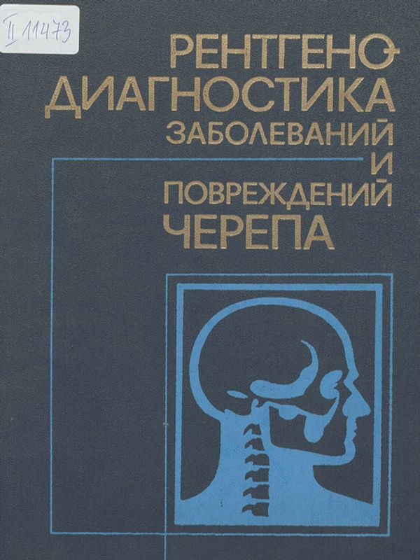 Рентгенодиагностика заболеваний и повреждений черепа