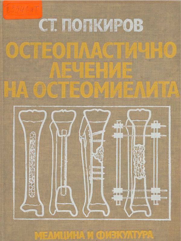 Остеопластично лечение на остеомиелита