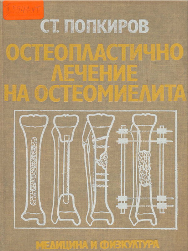 Остеопластично лечение на остеомиелита