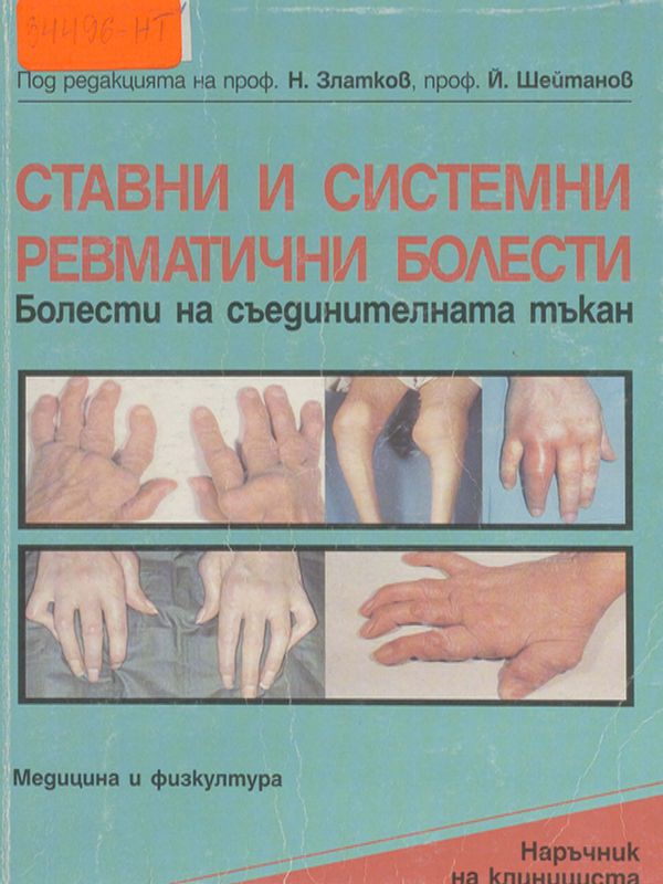 Ставни и системни ревматични болести