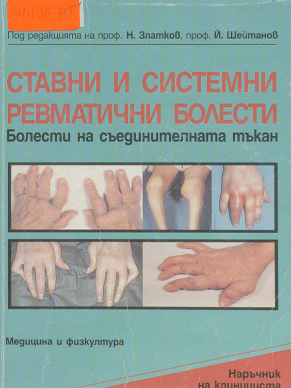 Ставни и системни ревматични болести