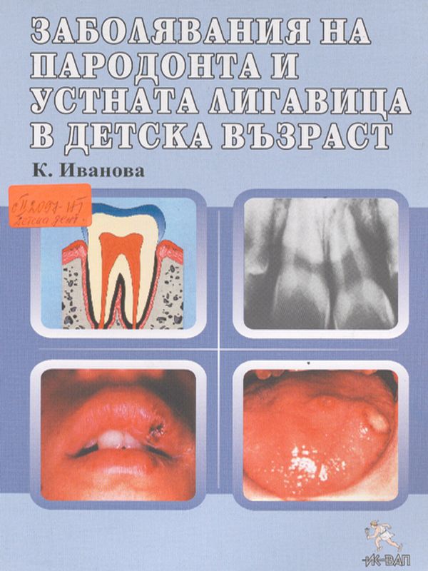 Заболявания на пародонта и устната лигавица в детска възраст