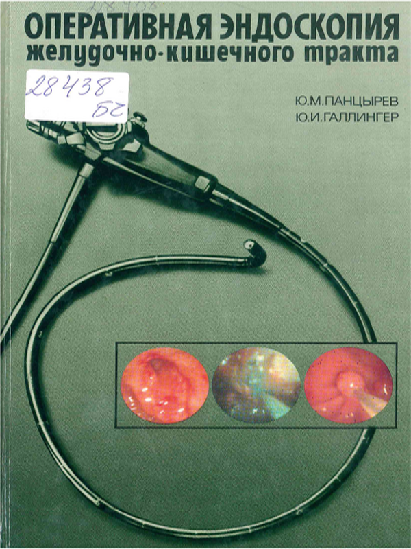 Оперативная эндоскопия желудочно-кишечного тракта