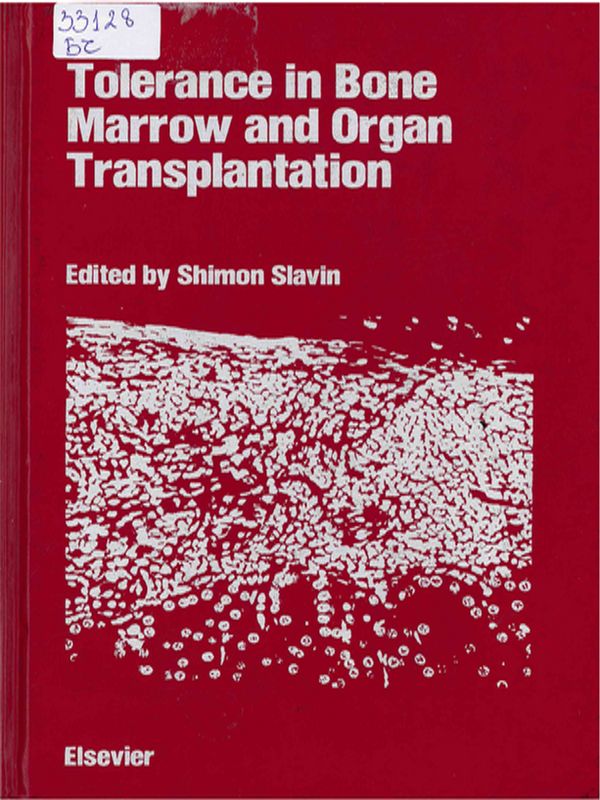 Tolerance in Bone Marrow & Organ Transplantation