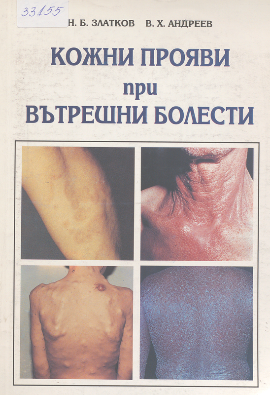 Кожни прояви при вътрешни болести