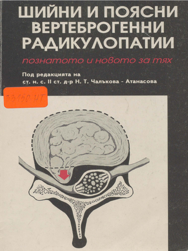 Шийни и поясни вертеброгенни радикулопатии