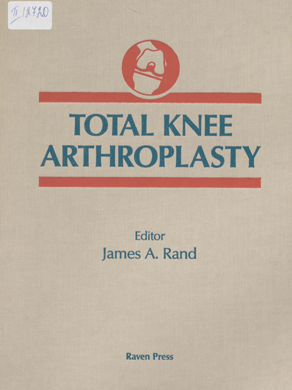 Total knee arthroplasty