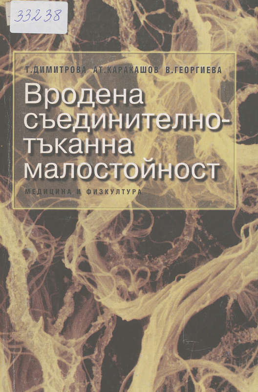 Вродена съединително-тъканна малостойност