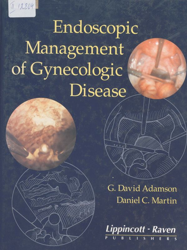 Endoscopic Management of Gynecologic Disease