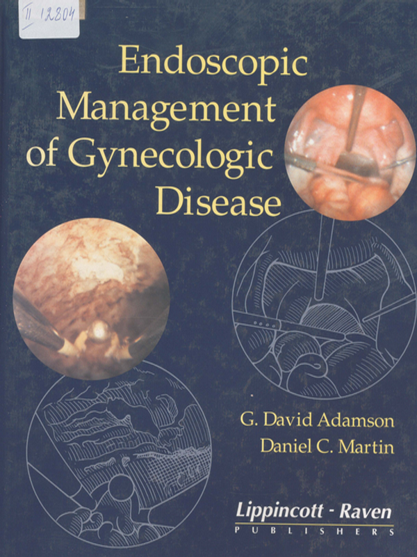 Endoscopic Management of Gynecologic Disease