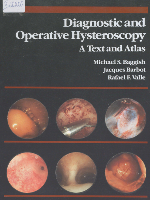 Diagnostic and operative hysteroscopy