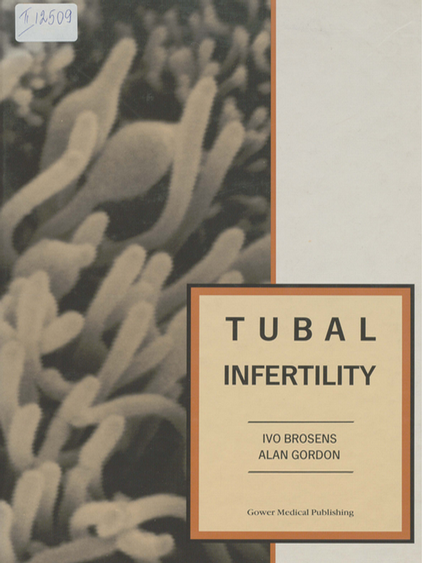 Tubal Infertility