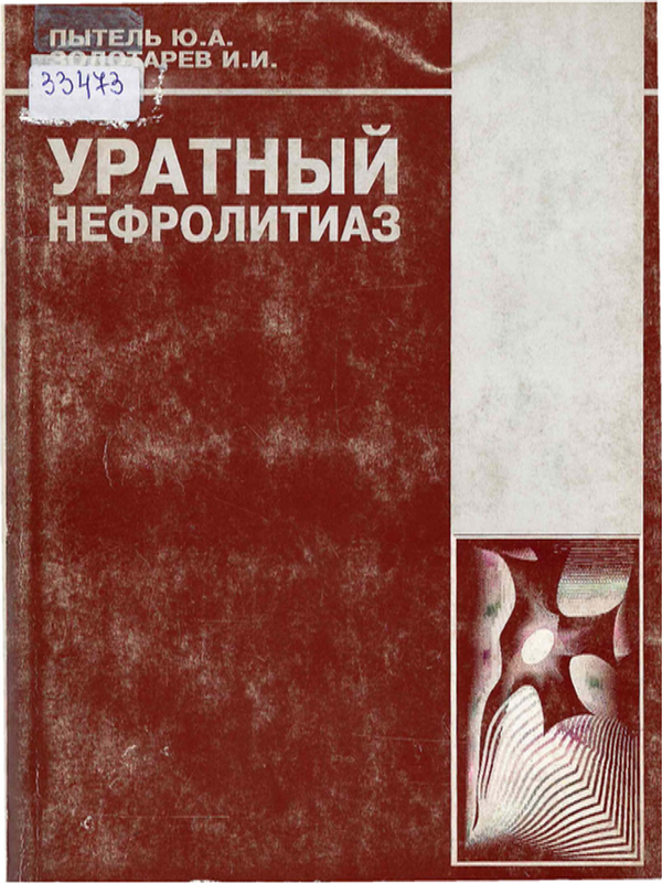 Уратный нефролитиаз