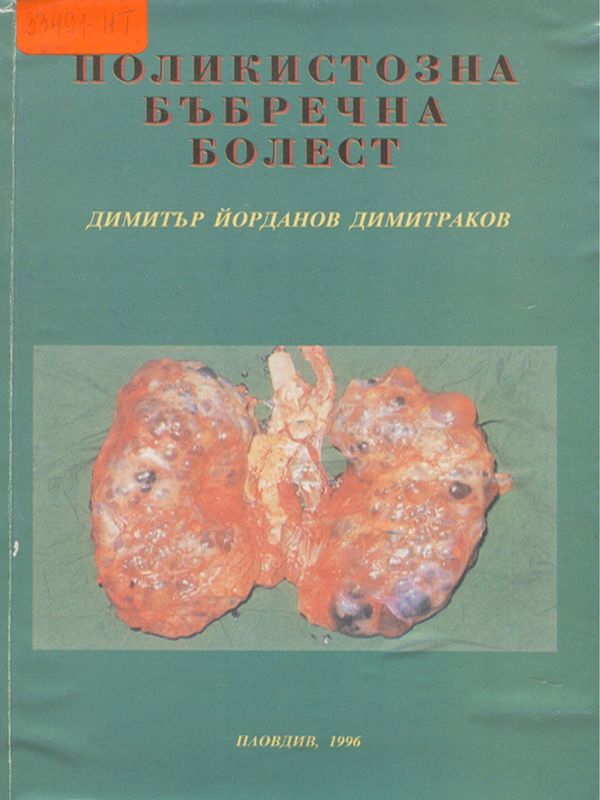 Поликистозна бъбречна болест